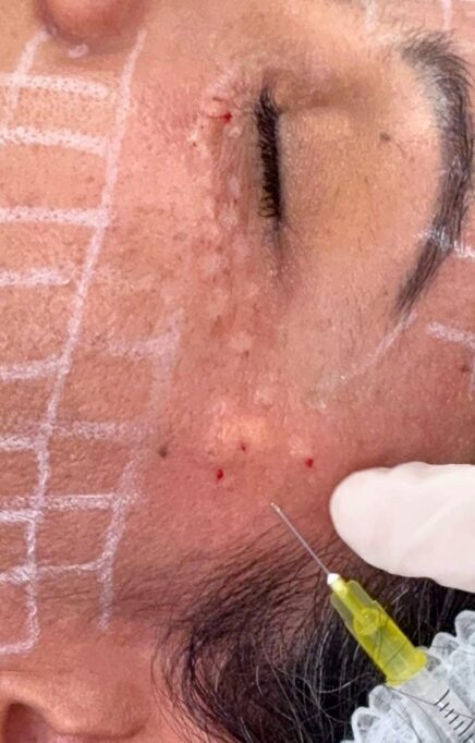 skinbooster2